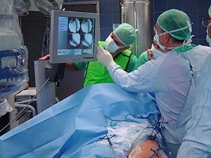 лечение аритмии сердца в Израиле