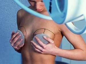 Импланты для грудных желёз