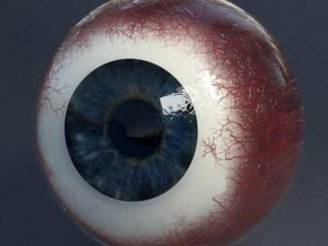 Как проводится лечение стекловидного тела глаза в клиниках Израиля