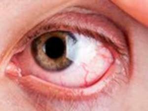 Израиль лечение сетчатки глаза thumbnail