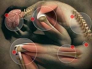Как лечат миопатию клиниках Израиля