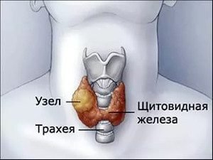 Лечение щитовидной железы в израиле цены thumbnail