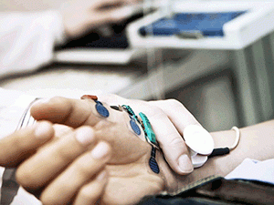 Диагностика неврологических заболеваний в Израиле: электромиография