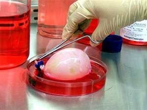 Формирование искусственных путей вывода мочи после операции