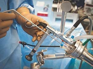 Хирургическое лечение рака толстой кишки в Израиле