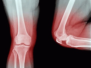 Проведение сцинтиграфии в израильских клиниках
