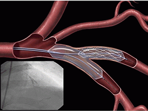 Кардиология в Израиле