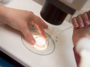 Лечение азооспермии в Израиле