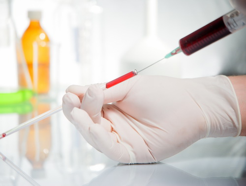 Лечение эритремии в Израиле: комплексная высокоэффективная терапия