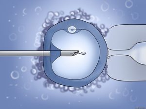 Интрацитоплазматическая инъекция сперматозоида