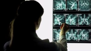 Лечение болезни Рейно в Израиле