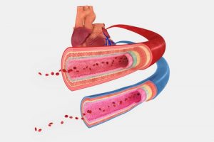 Лечение болезни Рейно в Израиле