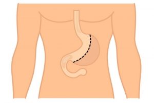 Желудочно-кишечный тракт