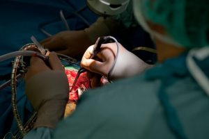 Операции на головном мозге в Израиле