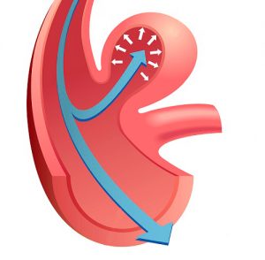 Операции на головном мозге в Израиле