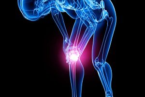 Артроскопия в Израиле