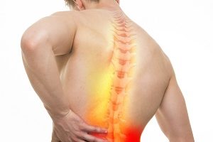 Лечение фибромиалгии в Израиле